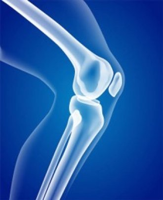 Image of x-ray 