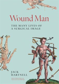 Cover of "Wound Man," light blue background with image of man pierced by many different weapons.